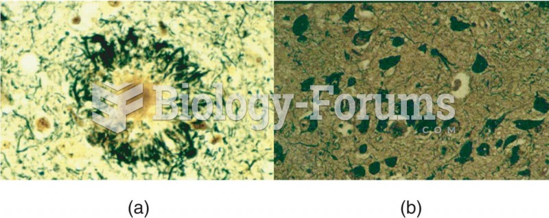 Microscopic Features of Alzheimer’s Disease 