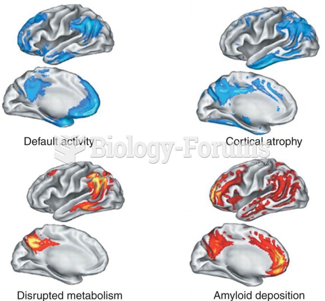 Default Activity in the Alzheimer Brain 