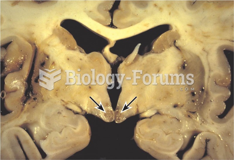 Korsakoff’s Syndrome 