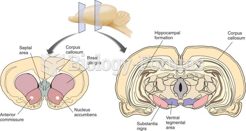 The Ventral Tegmental Area and the Nucleus Accumbens 