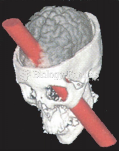 Phineas Gage’s Accident 
