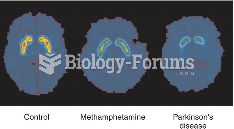 Dopamine Transporters, Methamphetamine Abuse, and Parkinson’s Disease 