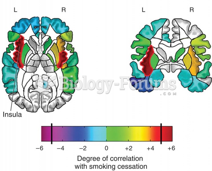 Damage to the Insula and Smoking Cessation 