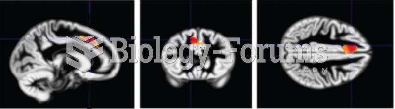 Early Stress and the Prefrontal Cortex 