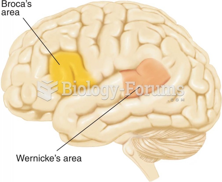 Speech Areas