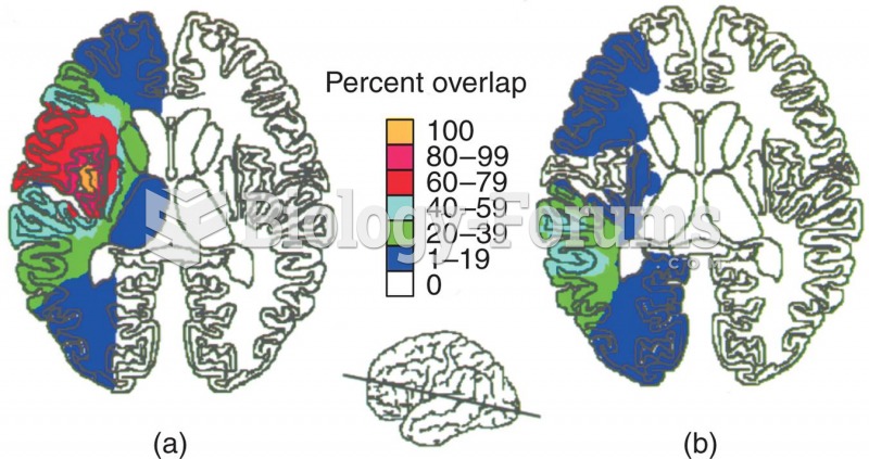 Involvement of the Insular Cortex in Speech Articulation 