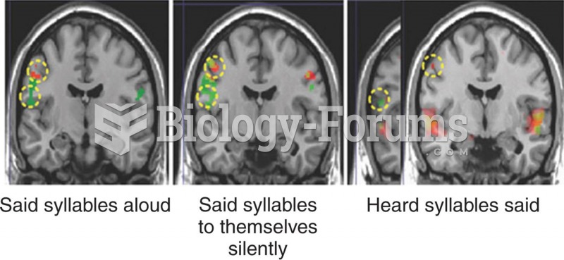 Mirror Neurons and Speech 