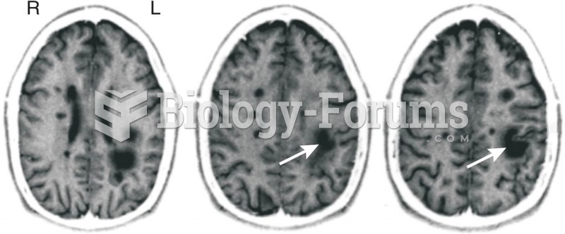 Conduction Aphasia 