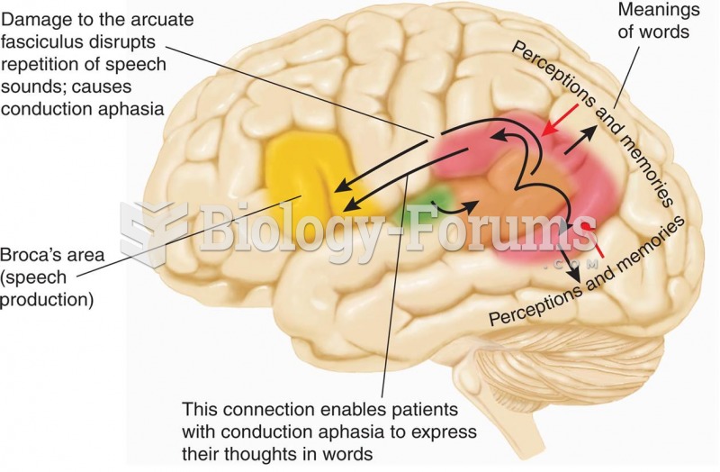 A Hypothetical Explanation of Conduction Aphasia 
