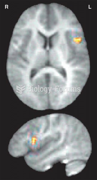 Mirror Neurons in Broca’s Area 