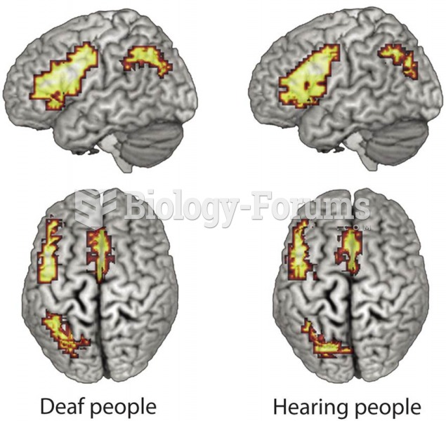 Brain Activation During a Rhyming Task 