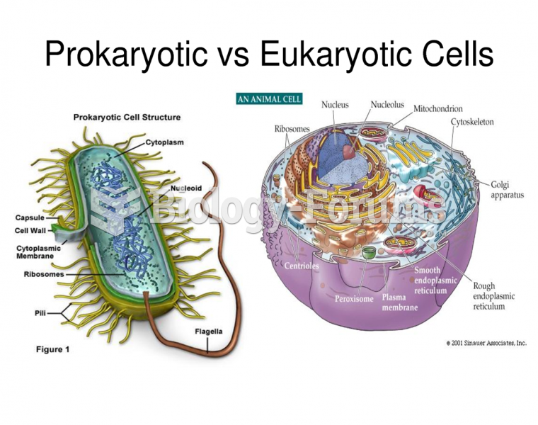Prokaryotic vs. Eukaryotic cells