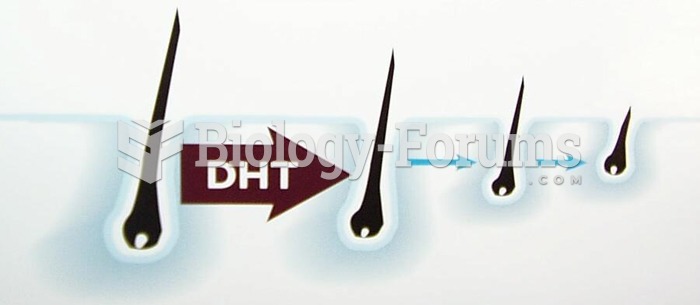 Hair loss due to DHT