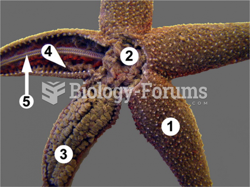 Echinoderm Diagram with labels