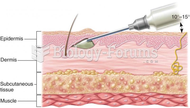 Intradermal drug administration: (a) cross section of skin showing depth of needle insertion Source: