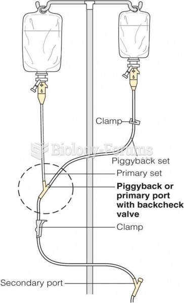 Secondary intravenous lines: (b) an intravenous piggyback (IVPB) alignment