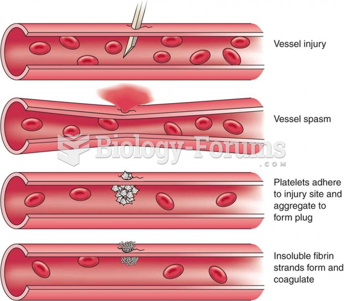 Basic steps in hemostasis