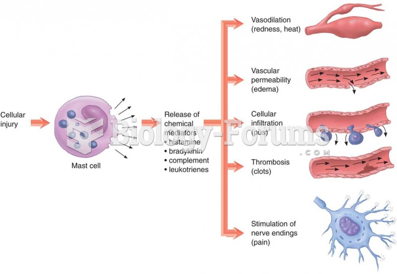 Steps in acute inflammation 