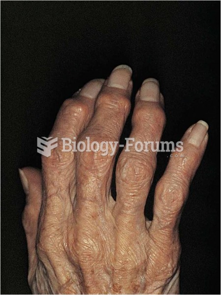 Patient with osteoarthritis