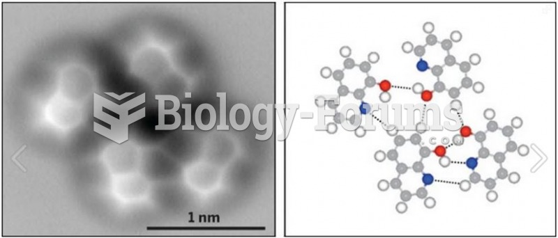 Chemical bonds