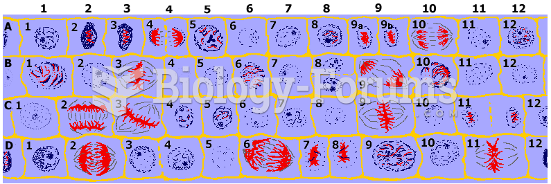 microscope view of an onion root tip