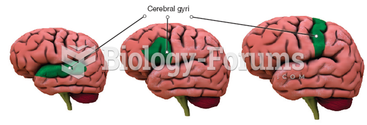 Does Intelligence Increase with Brain Size? 