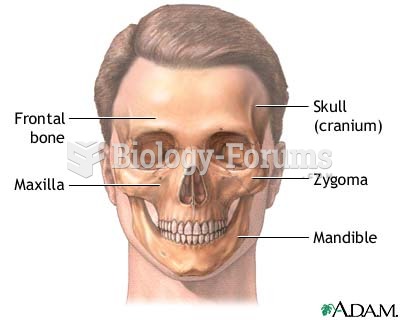 Main Facial Bones