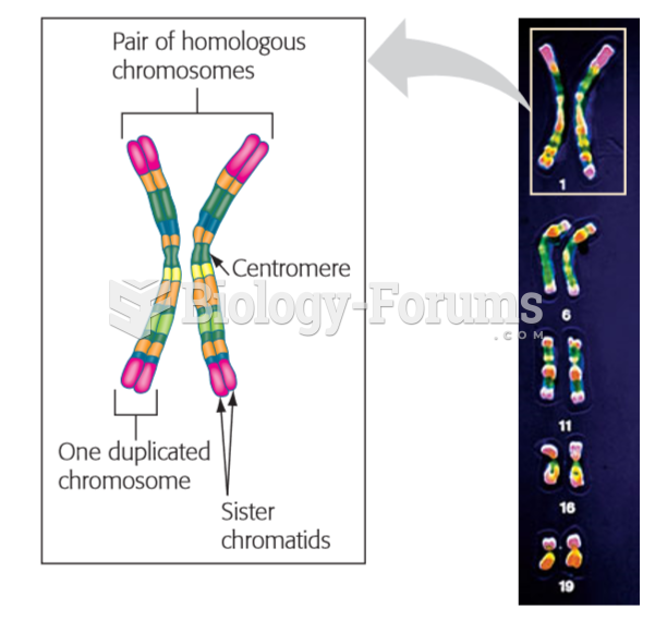 pair of homologous chromosomes