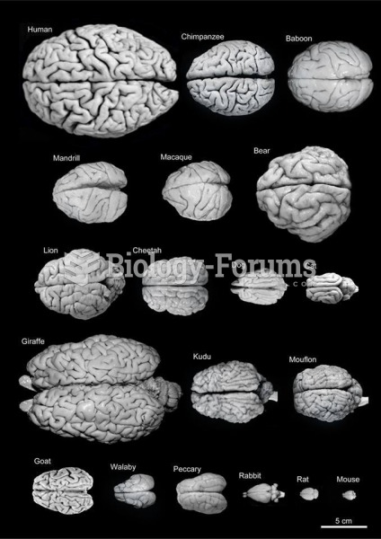 An image comparing the brain sizes of different species.