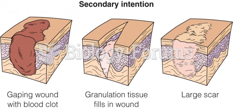 Wound healing by primary intention.