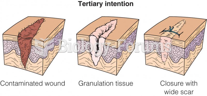 Wound healing by tertiary intention.