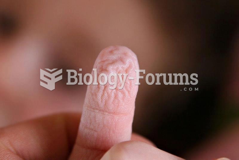 Wrinkly finger