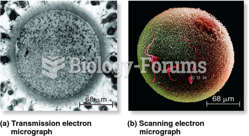 A comparison of transmission and scanning electron microscopy