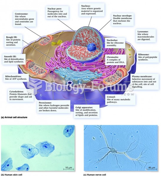 General structure of an animal cell