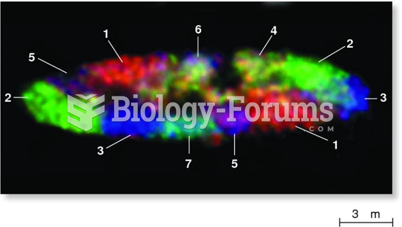 Chromosome territories in the cell nucleus