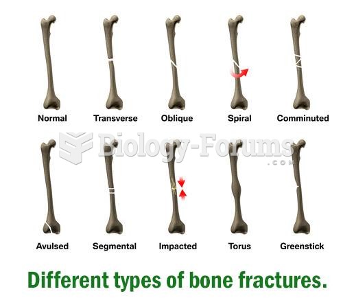 Different types of bone fractures