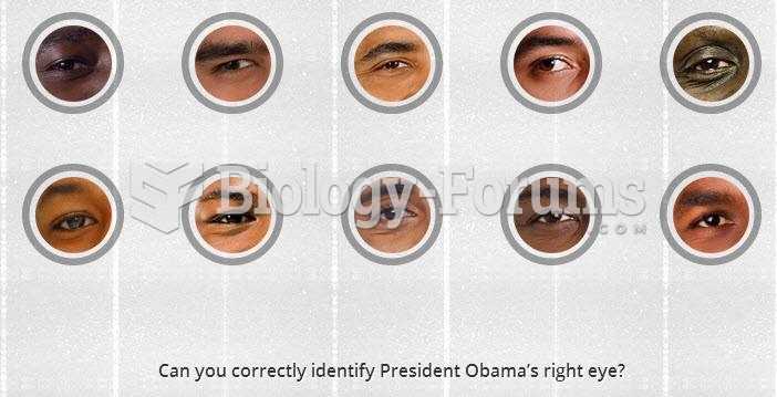 Obama's eye