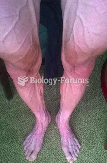 Legs after a bike ride