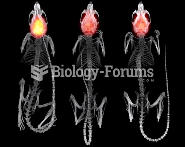 Blood-brain barrier