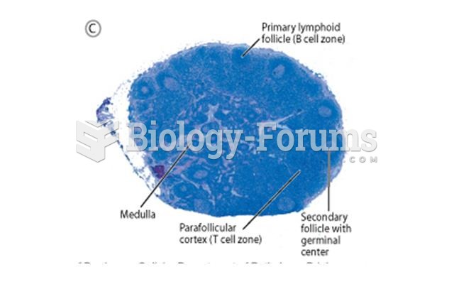 Morphology of a lymph node