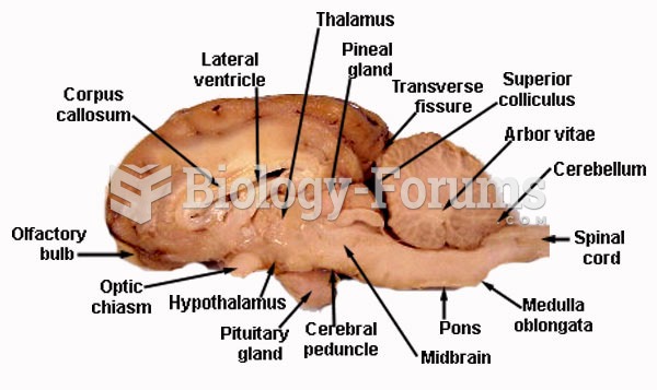 Sheep brain Sagittal view