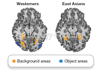 Brain activity varies by culture 