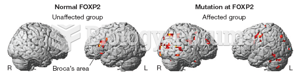 Brain Scans of KE Family