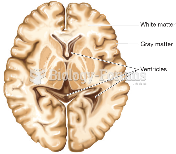 Gray and White Matter of the Brain 