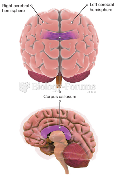 The Corpus Callosum 