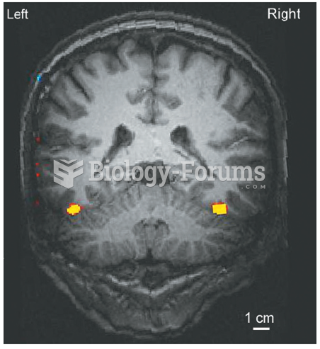 functional magnetic resonance imaging 