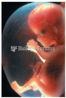 Fetal Stage: 8 Weeks To Birth