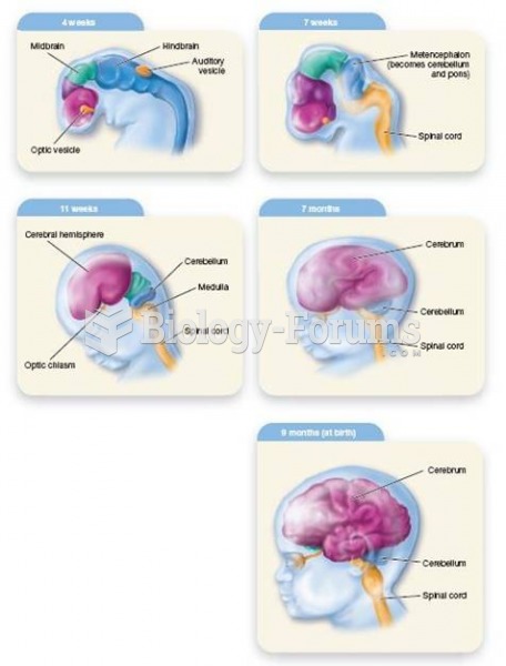 Prenatal Brain Development 