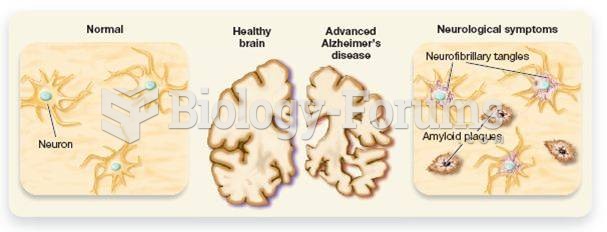 How Alzheimer's Affects the Brain 