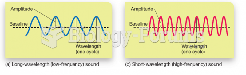 Characteristics of Sound: Frequency and Amplitude 